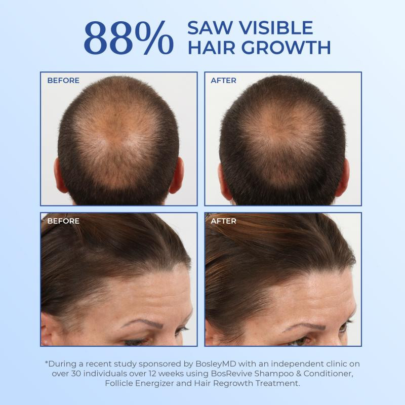 Bosley - Ensemble de départ pour cheveux naturels – Image 5