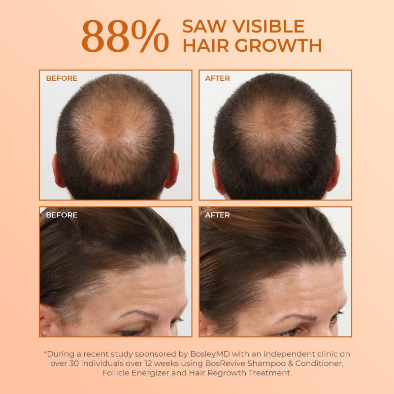 Bosley - Ensemble de départ pour cheveux colorés – Image 5