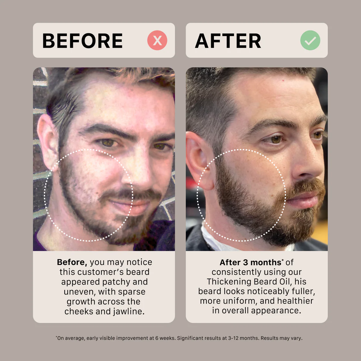 Actiiv - Huile À Barbe Épaississante Classique 30ml – Image 5