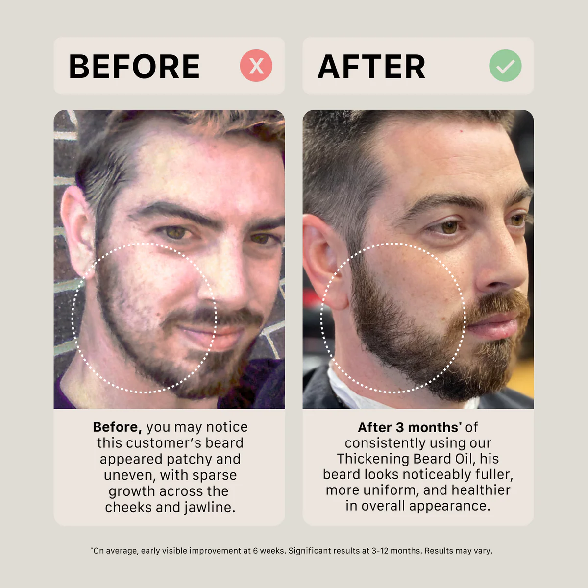 Actiiv - Huile À Barbe Épaississante Sans Odeur 30ml – Image 6