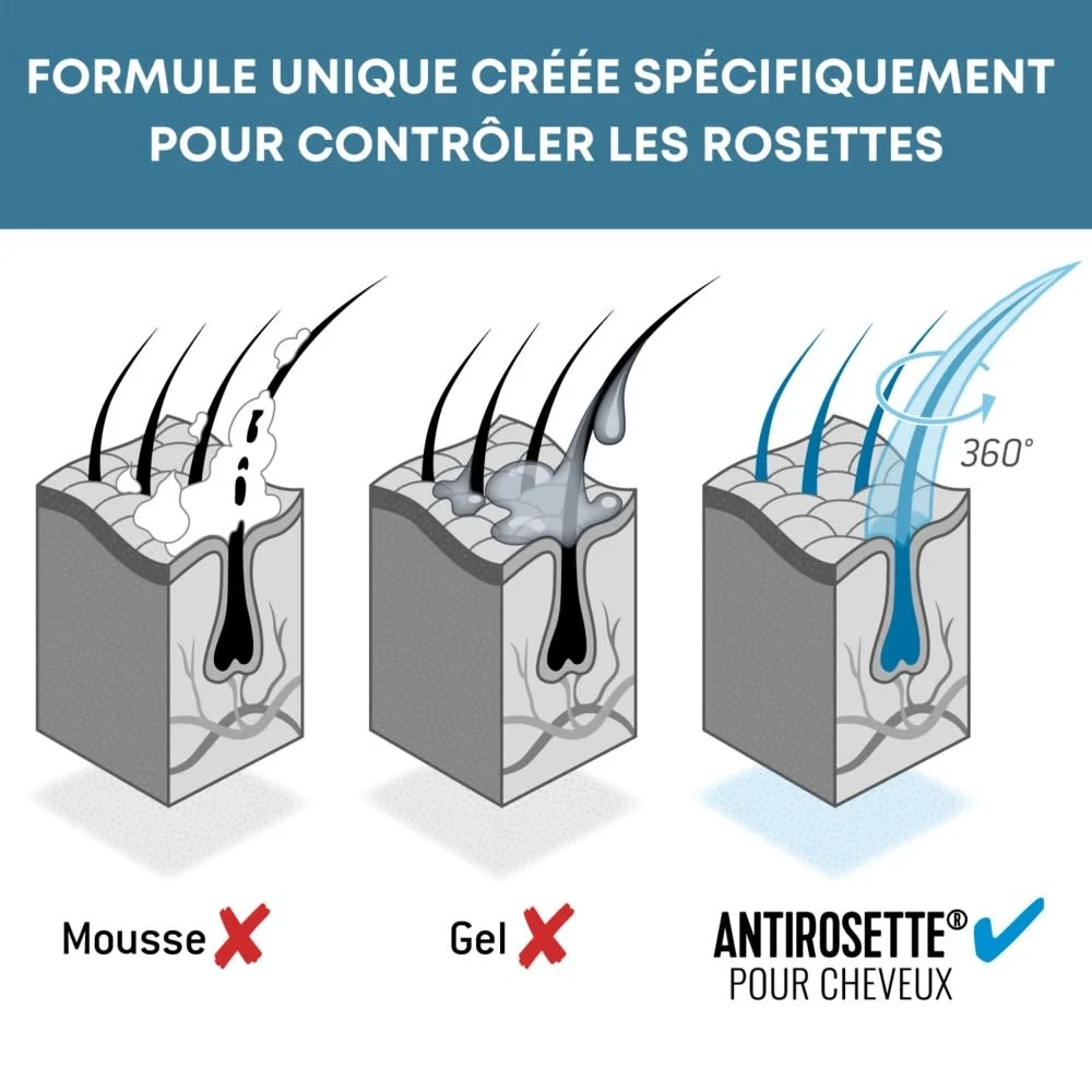 Luc Vincent - Vaporisateur Antirosette 150ml – Image 2