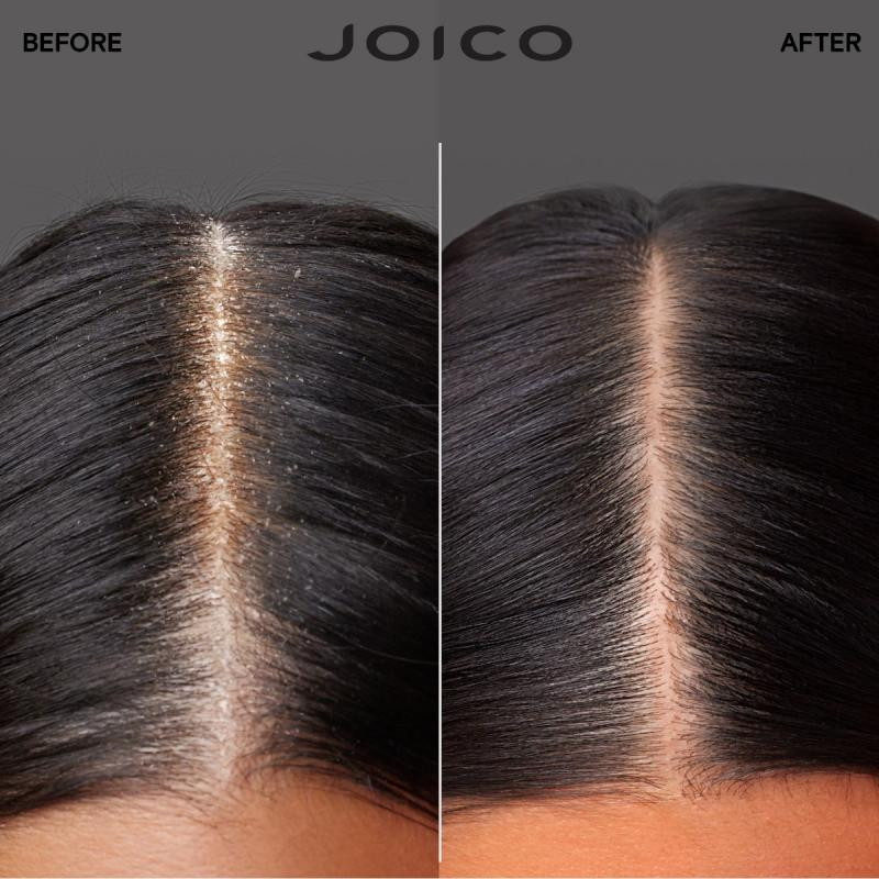 Joico - Essence Nourrissante Scalp Vitality 100ml – Image 4