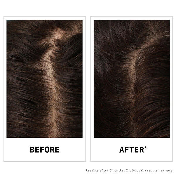 Nioxin - Shampoing Hair Fall Defense Ultimate Power 240ml – Image 5