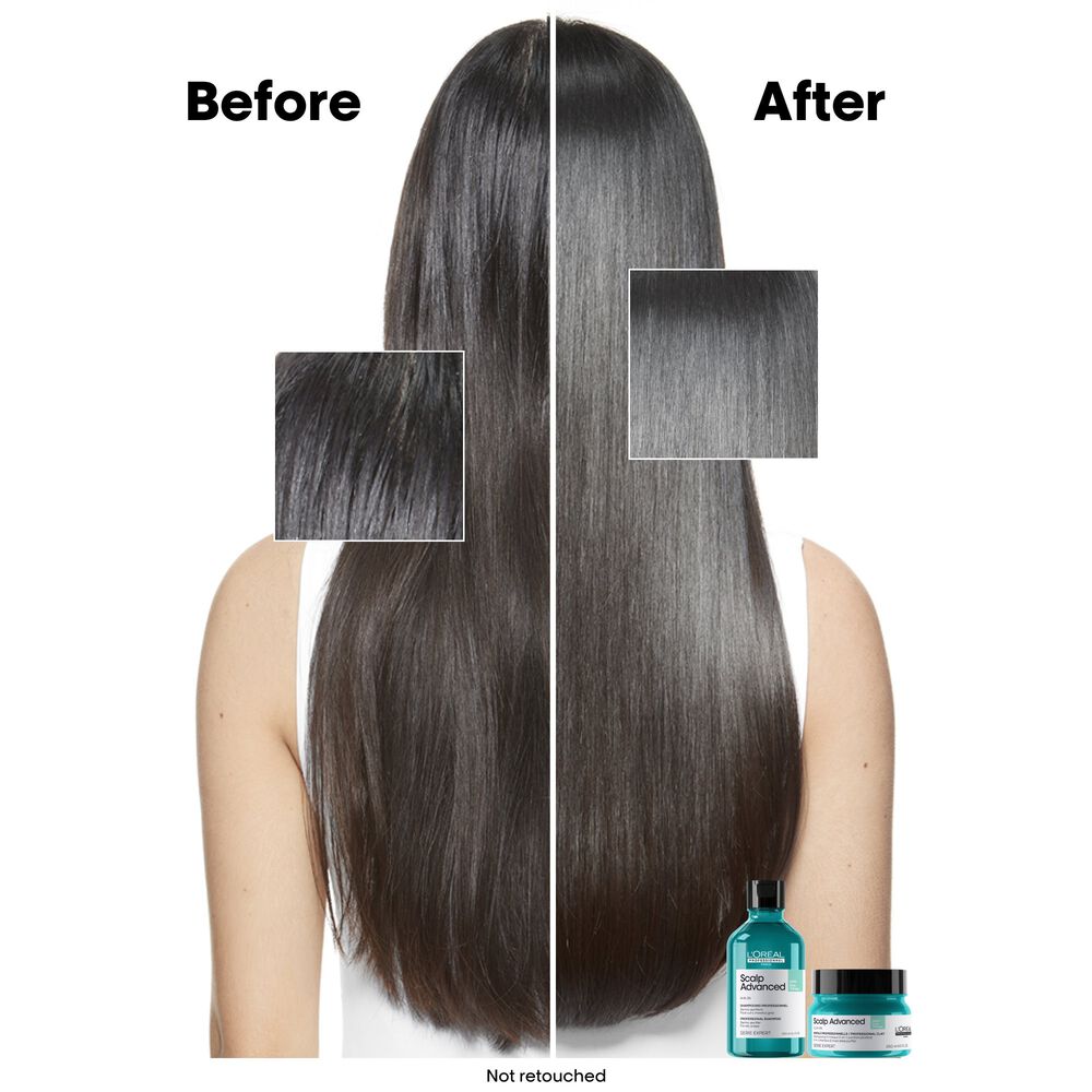 L’Oréal Professionnel – Shampoing purifiant 1500ml – Image 2