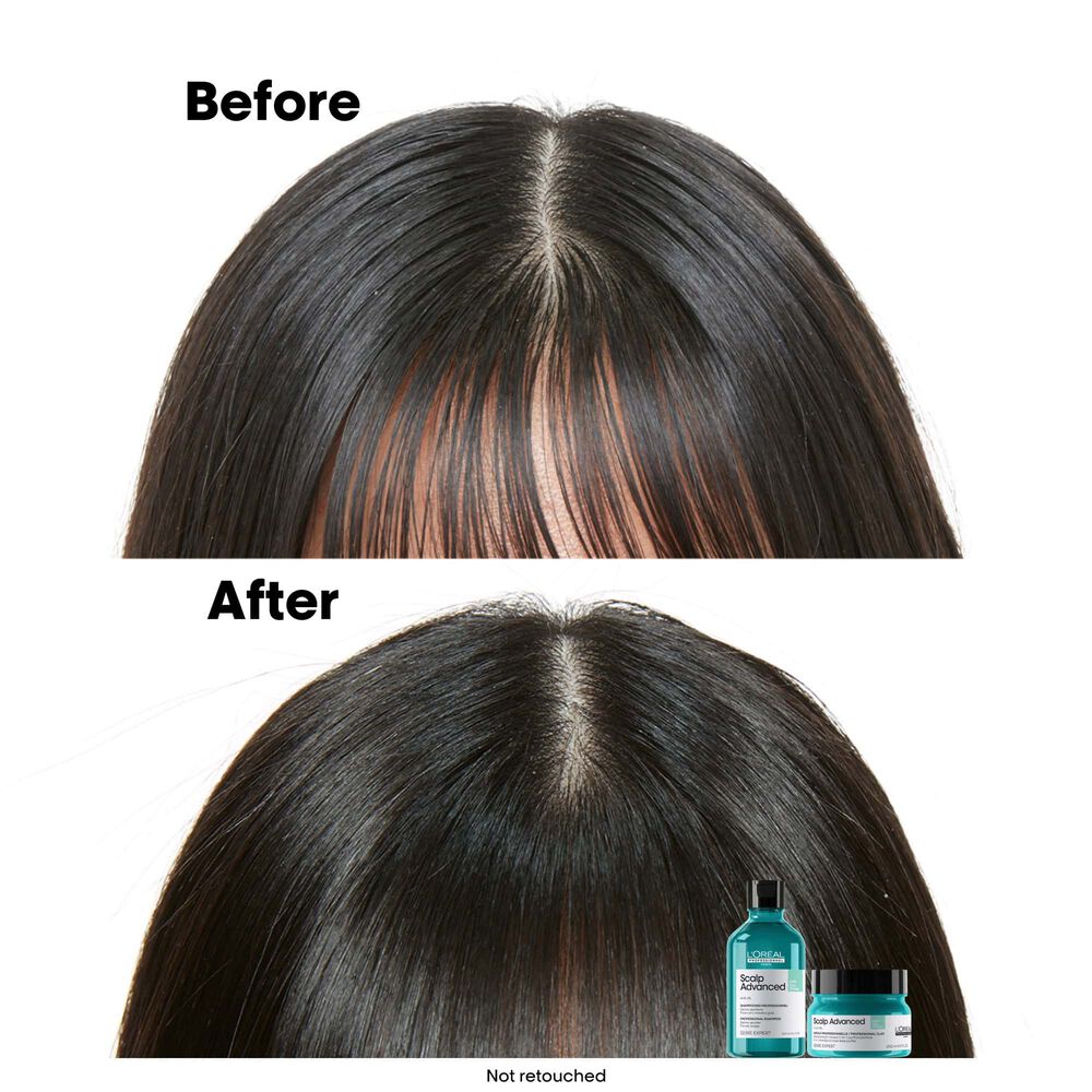 L’Oréal Professionnel – Shampoing purifiant 1500ml – Image 3