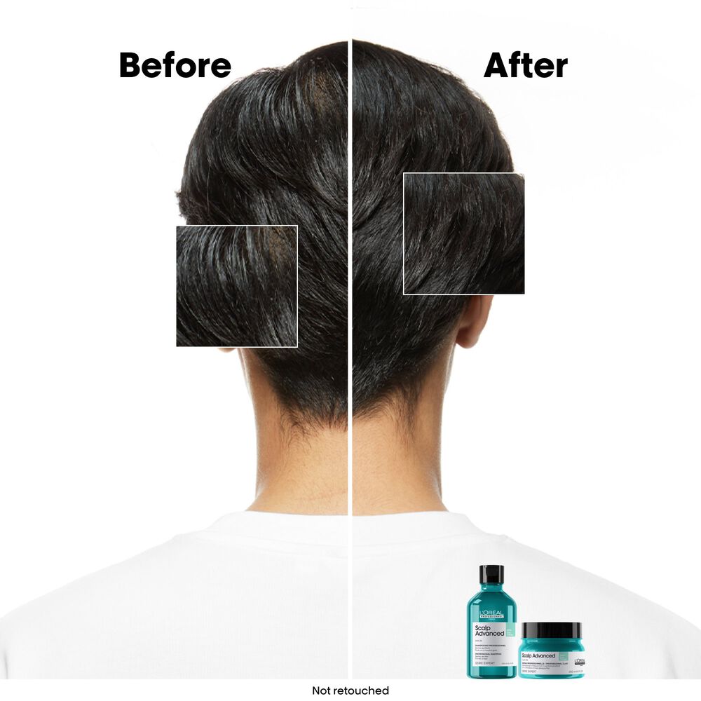 L’Oréal Professionnel – Shampoing purifiant 1500ml – Image 4