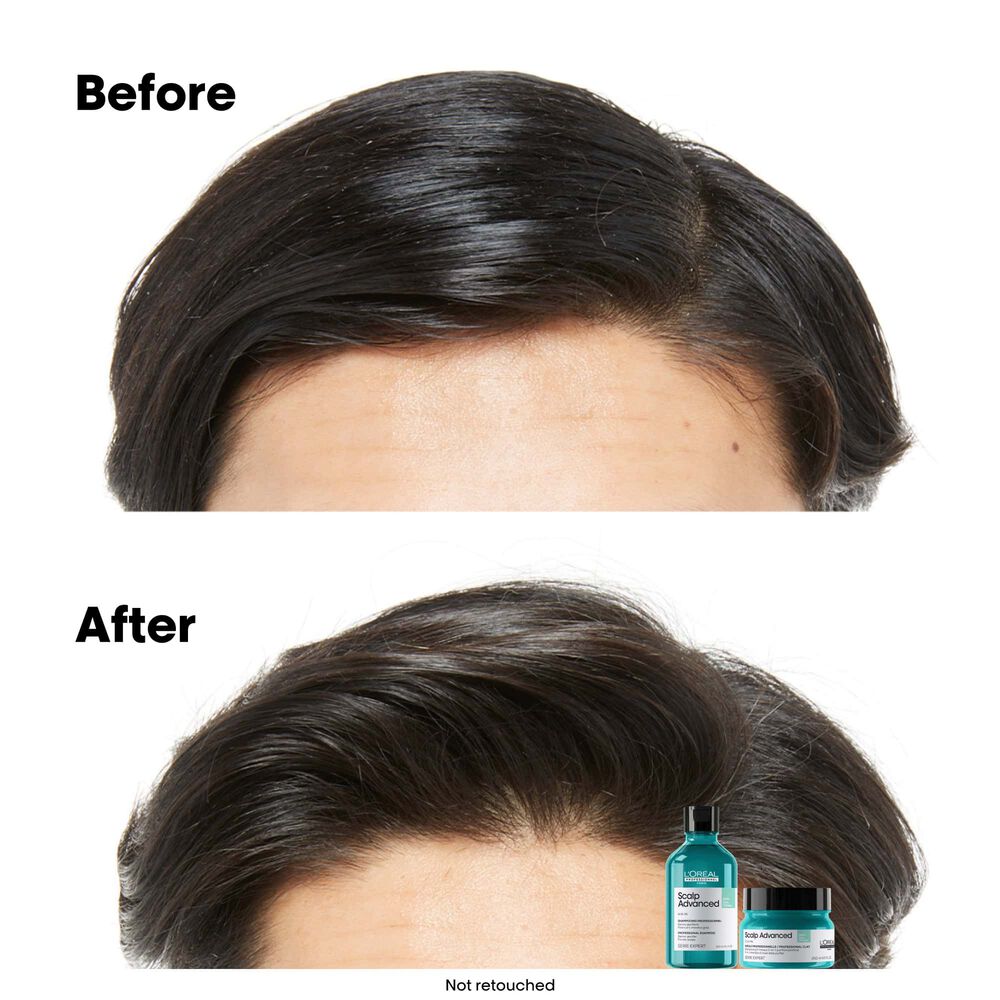 L’Oréal Professionnel – Shampoing purifiant 1500ml – Image 5