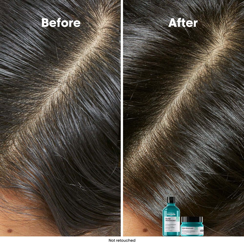 L’Oréal Professionnel – Shampoing purifiant 1500ml – Image 6