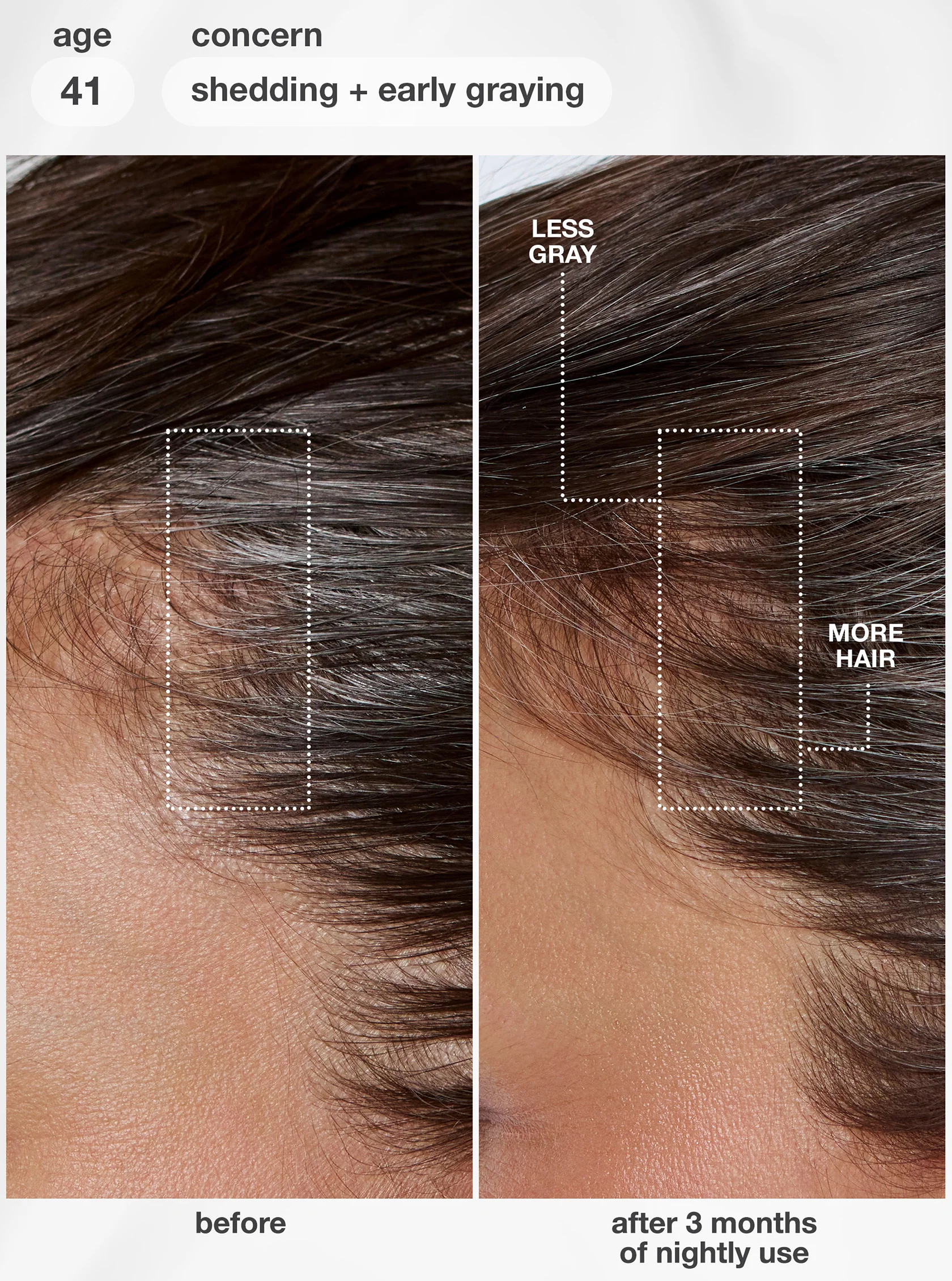 K18 - Sérum De Longivité FutureIQ 90ml – Image 3