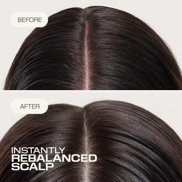 Goldwell - Fluide Réequilibrant Scalp Specialist 150ml – Image 3