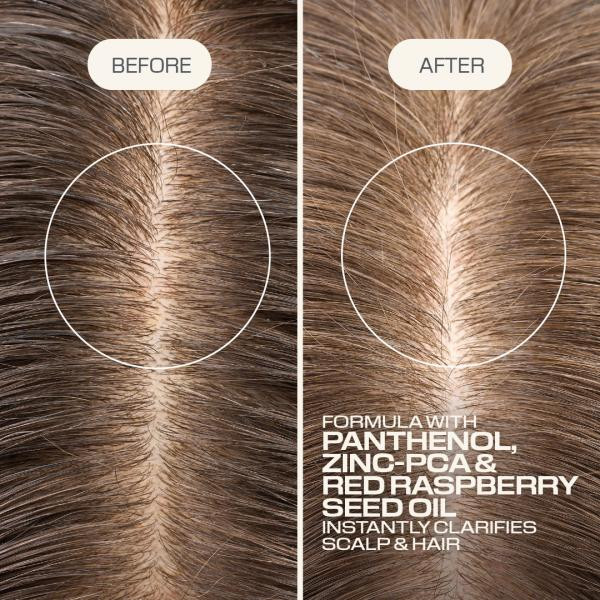 Goldwell - Shampoing Purifiant Scalp Specialist 300ml – Image 3