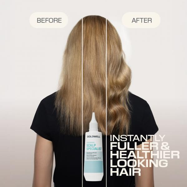 Goldwell - Sérum Densifiant Scalp Specialist 150ml – Image 3